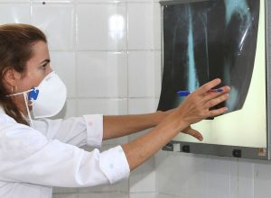 oms-recomenda-testes-de-diagnostico-rapido-para-erradicar-tuberculose